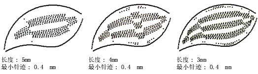 如何用自動分割針跡來分割長針跡